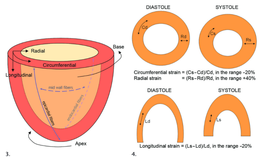 Strain direction schematic used as tagged-MRI deformation context
