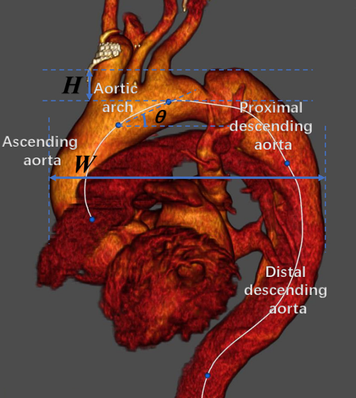 Aortic arch height and width measurement schematic from the manuscript image cache