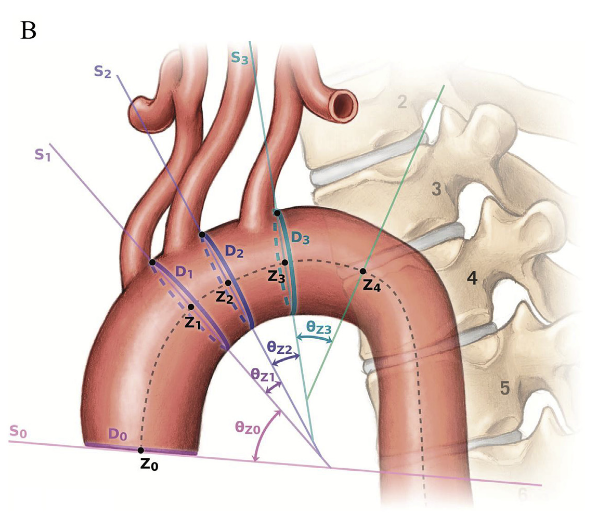 Aortic zone landmark schematic from the manuscript image cache