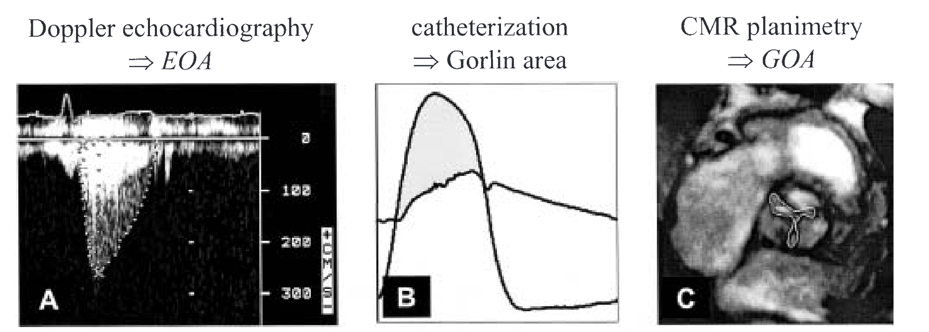 Aortic valve area measurement context from the manuscript image cache
